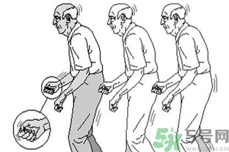 帕金森要注意哪些措施？帕金森的飲食需注意什么？