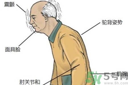 帕金森的易發(fā)人群有哪些？如何預(yù)防帕金森？