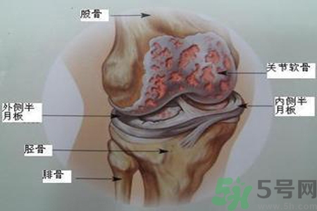 預(yù)防骨病需要注意哪些姿勢(shì)？秋季預(yù)防骨病的方法有哪些？