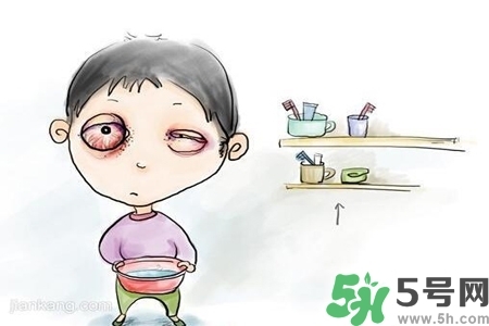 寶寶為什么會(huì)感染紅眼??？寶寶患紅眼病如何治療？