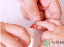 寶寶長(zhǎng)蘚是怎么回事？寶寶長(zhǎng)蘚怎么辦？