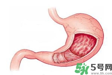 急性腸胃炎哪些食物不可以吃？急性腸胃炎不能吃的水果有？