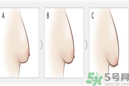 胸部松弛的原因是什么？胸部松弛該怎么辦？