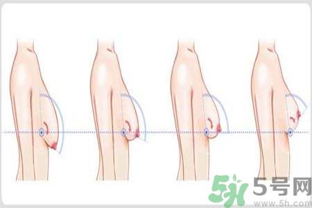 胸部松弛的原因是什么？胸部松弛該怎么辦？