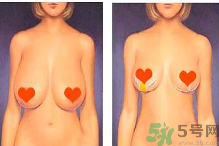 如何預(yù)防胸部松弛？吃什么能使胸部挺拔？