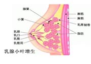 乳腺增生治療方法是什么？乳腺增生的檢查方法有哪些？