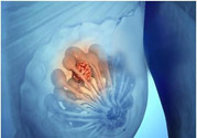 乳房有硬塊正常嗎？乳房有腫塊怎么回事？