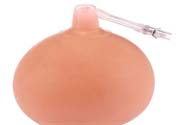 乳頭內(nèi)陷可以拔罐嗎？乳頭內(nèi)陷需要手術(shù)治療嗎？