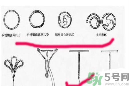 避孕的辦法有什么？避孕的方法有哪些？