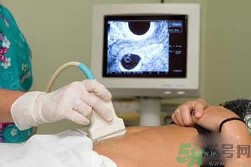 孕婦做b超要空腹嗎？孕婦做b超要不要空腹？