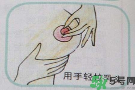 乳頭內(nèi)陷怎么矯正？乳頭內(nèi)陷矯正方法是什么？