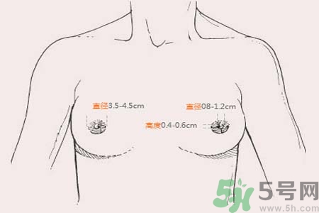 乳頭內(nèi)陷能不能喂奶？乳頭凹陷怎樣哺乳？