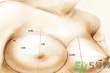乳頭內(nèi)陷可以用吸奶器嗎？乳頭內(nèi)陷能不能用吸奶器？