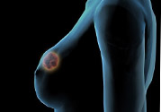 哺乳期乳房有硬塊疼痛怎么辦？如何預(yù)防哺乳期乳房有硬塊？