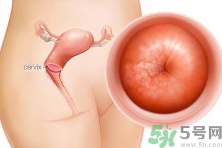 陰道干澀的原因是什么？陰道干澀怎么辦？