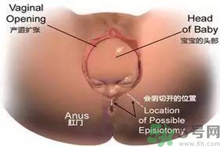 女性陰道松弛的原因是什么？女性陰道松弛怎么辦？