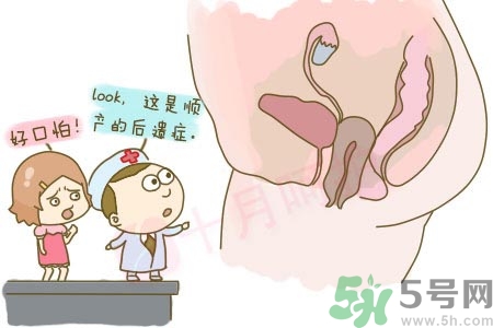 陰道松弛是什么？陰道松弛的癥狀有哪些？