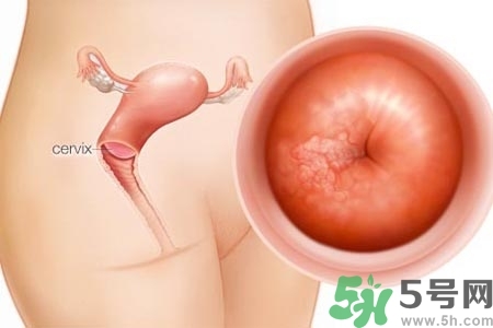 陰道出血和什么有關(guān)？陰道出血的應急措施有哪些？