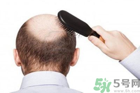 男性衰老的年齡段是什么？各年齡段男性抗衰老法則