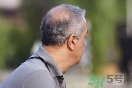 男性衰老的征兆有哪些？男性10個(gè)難以逆轉(zhuǎn)的衰老征兆