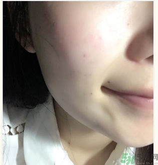 麗得姿面膜適合孕婦可以用嗎？麗得姿面膜哪些孕婦可以用？
