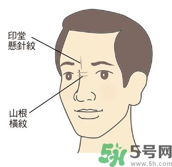 耳垂上有豎紋是怎么回事？山根有橫紋是什么??？