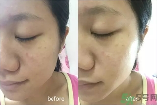rilastil面膜使用方法 維納斯蒂爾面膜怎么用？