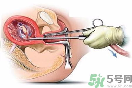 人工流產后多久可以再次懷孕？流產后需要注意什么？