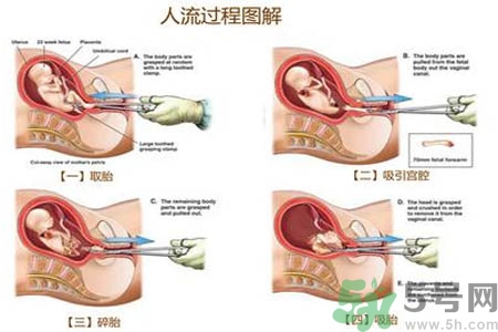 人流后怎么調(diào)養(yǎng)身體？人流后飲食需注意什么？