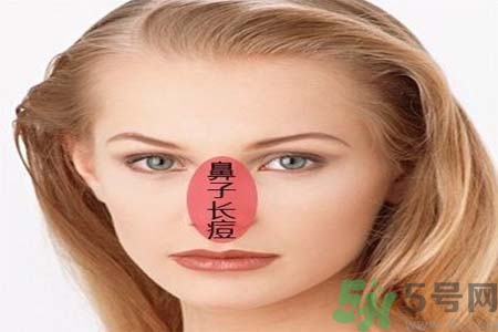 鼻翼長痘痘怎么辦？鼻翼長痘解決方法有哪些？
