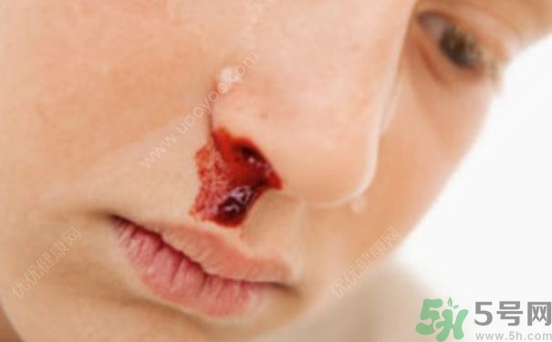 15歲男孩可以刮胡子嗎？15歲男孩經常流鼻血怎么回事？