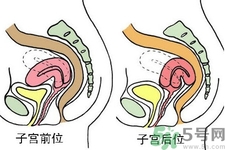 ?子宮移位怎么治療？子宮移位能懷孕嗎？