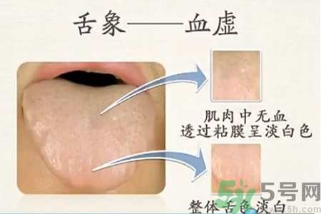 血虛怎么調(diào)理？女人血虛怎么調(diào)理？