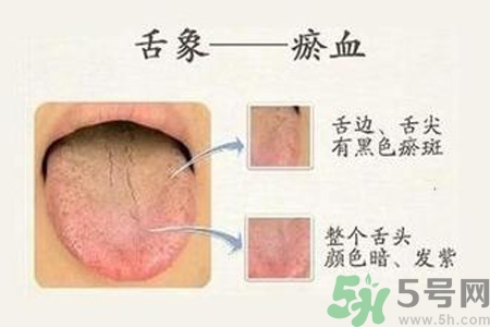 血瘀體質(zhì)吃什么？血瘀體質(zhì)怎么調(diào)理？