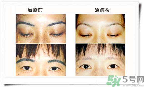 紋眉毛有什么危害？紋眉后注意事項