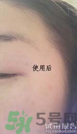 dr.jart適合什么年齡層？蒂佳婷適合年齡