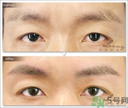眉毛怎么整形好看？眉毛怎么整自然？