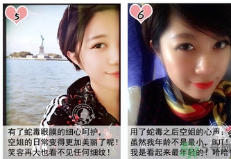 蛇毒眼膜孕婦可以用嗎？ 日本spa蛇毒眼膜孕婦能用嗎？