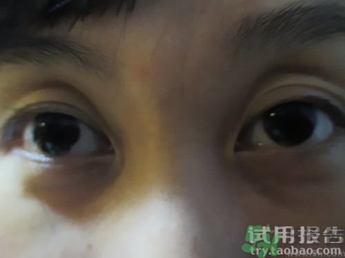 蛇毒眼膜效果怎么樣？spa蛇毒眼膜紅色好用嗎？