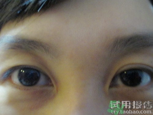蛇毒眼膜效果怎么樣？spa蛇毒眼膜紅色好用嗎？