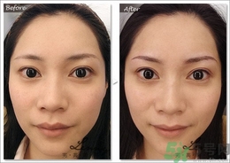 眉毛怎么整形好看？眉毛怎么整自然？