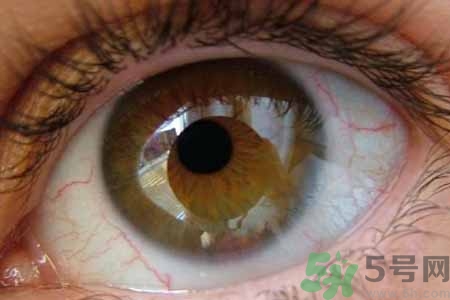 ?干眼癥的治療方法是什么？如何預(yù)防干眼癥？