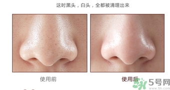 yu.r巧克力棒鼻貼怎么樣？yu.r巧克力鼻貼好用嗎？