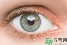 黑眼圈是怎么形成的？黑眼圈是什么原因引起的？