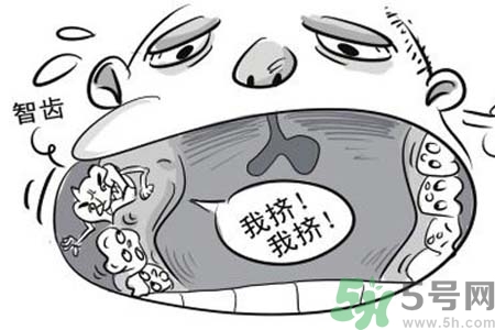 智齒一定要拔掉嗎？什么樣的智齒可以不拔？