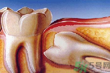 拔智齒一顆多少錢(qián)？拔除智齒收費(fèi)多少？