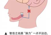 長智齒疼痛怎么辦？長智齒牙齦腫了怎么辦？