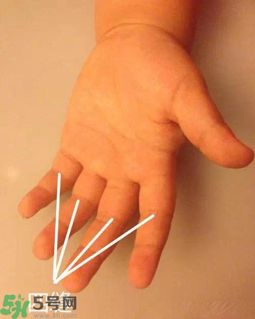 積食發(fā)燒怎么推拿？積食發(fā)燒推拿手法圖解