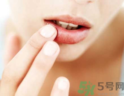 孕婦嘴唇干裂脫皮怎么回事？孕婦嘴唇干裂脫皮是缺什么