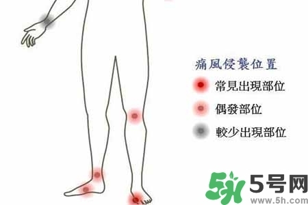 引發(fā)痛風(fēng)的原因是什么？痛風(fēng)病人飲食需注意什么好？